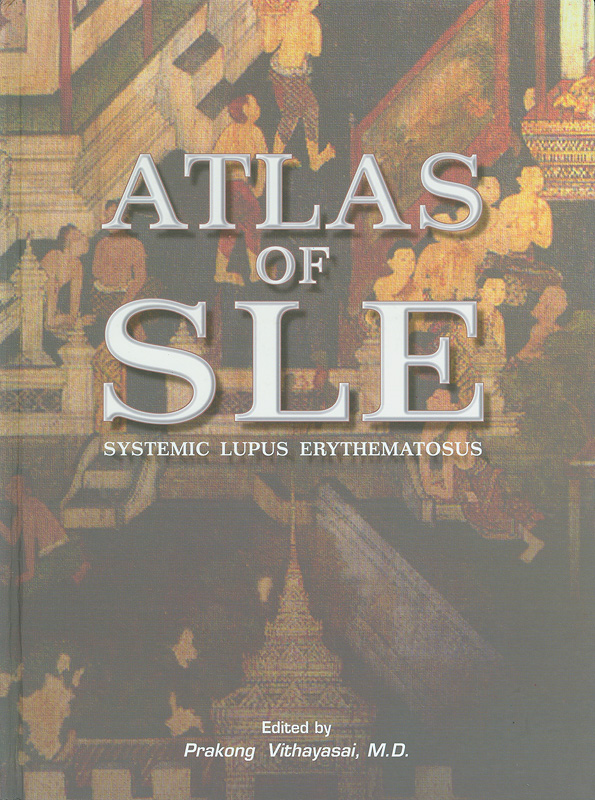 Atlas of systemic lupus erythematosus /Prakong Vithayasai, Kamthorn Thamprasert ||Atlas of SLE : systemic lupus erythematosus